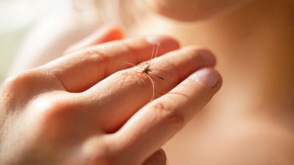 Die 5 wichtigsten Fakten zur Nanoplastia für Haare